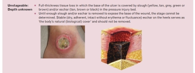 Unstageable Depth Unknown - 