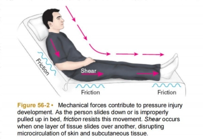Posisi Beresiko Luka Tekan - 