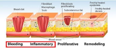 Tahap Penyembuhan Luka - 