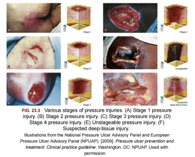 Stadium Luka Tekan - 