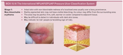 Stadium 1 Luka Tekan - 